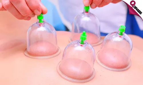 Ladies' Cupping Treatments: Gliding, Facial Massage, & Hijama at Al Hadi Medical!